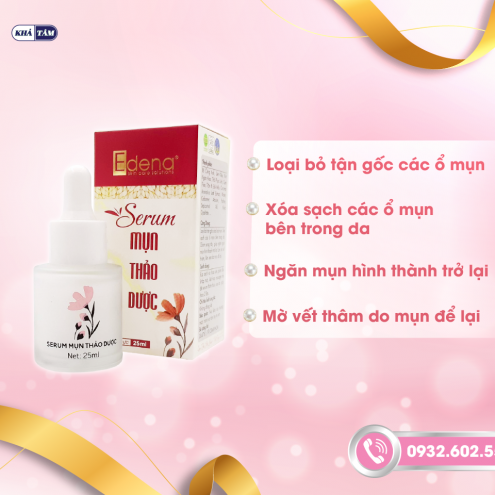 SERUM MỤN THẢO DƯỢC EDENA 25ML